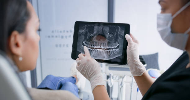 Licensed Tooth Extraction service in Parole, MD - Smile Center Dentistry
